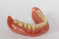 Vollprothese Vollprothese